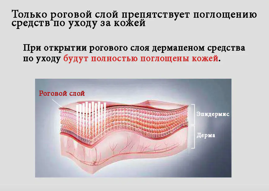 Картридж насадка для дермапена - 12 микроигл — изображение 3